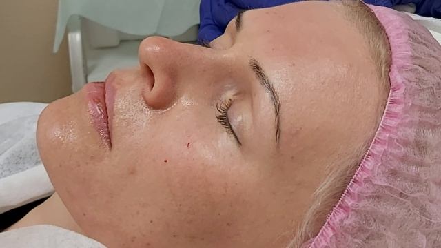 Ботокс и мезоботокс.