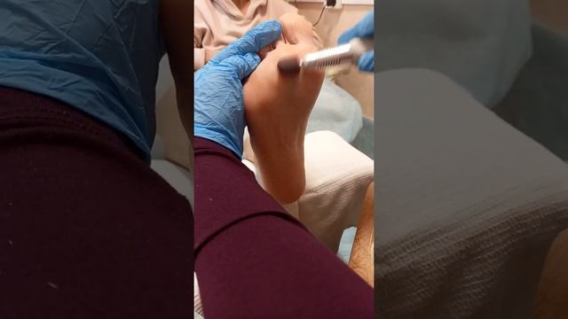 МК Аппаратный педикюр, обработка стопы. Школа педикюра.