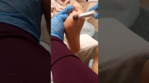 МК Аппаратный педикюр, обработка стопы. Школа педикюра.