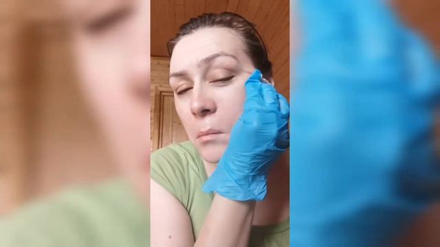 Делаю профессиональный пилинг дома| AHA & BHA Multi-Acid Peel 50%| Пилинг фирмы BTpeel