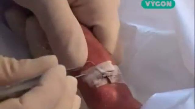 Процедура замены повязки смотреть онлайн