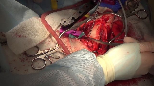 Хирургическое лечение застарелого повреждения передней крестовидной связки у собаки смотреть онлайн