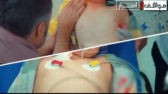 لأول مره أخطاء مسلسل الطبيب المعجزة محدش خد باله منها смотреть онлайн