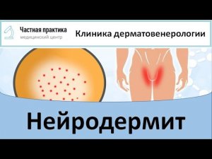 Нейродермит