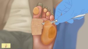 Асмр Анимация обморожения ног