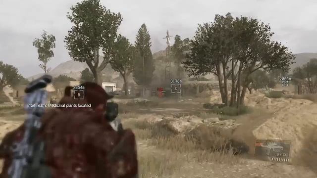 METAL GEAR SOLID V: THE PHANTOM PAIN trying my Infinity Bandana! смотреть онлайн