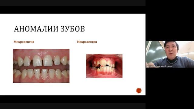 Лекция аномалии 2021 01 17 at 18 30 GMT 8 смотреть онлайн