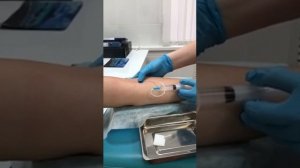 Традиционный забор крови из вены для анализов