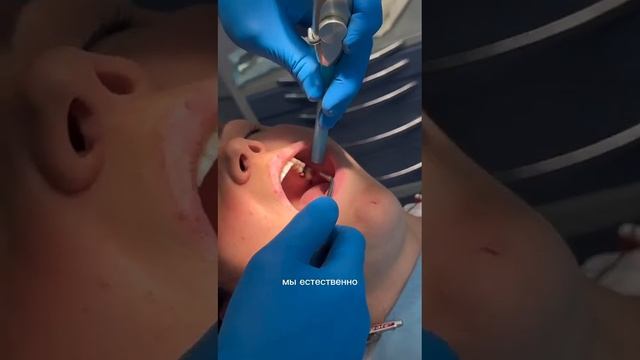 Почему кровит десна? Смотрим и слушаем. Задаём вопросы)! смотреть онлайн