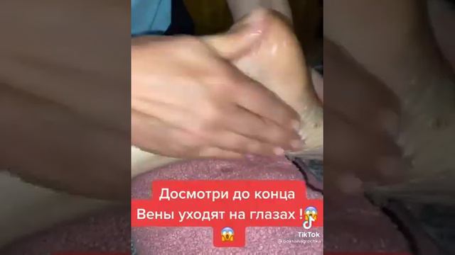 Ayagdakı damarları necə itirmək olar. смотреть онлайн