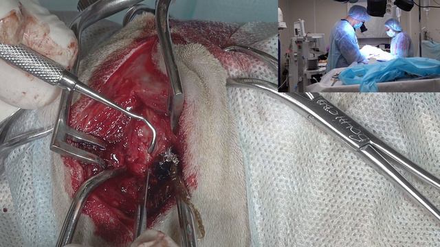 Расширение цистерны магна. смотреть онлайн