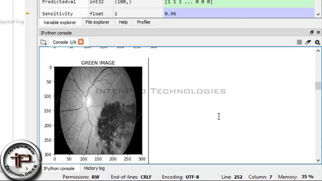 Diabetes Retinopathy Image Segmentation and Classification in Fundus Image using SVM In PYTHON - DI смотреть онлайн