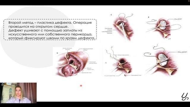Врожденные пороки сердца | ОХиТА смотреть онлайн