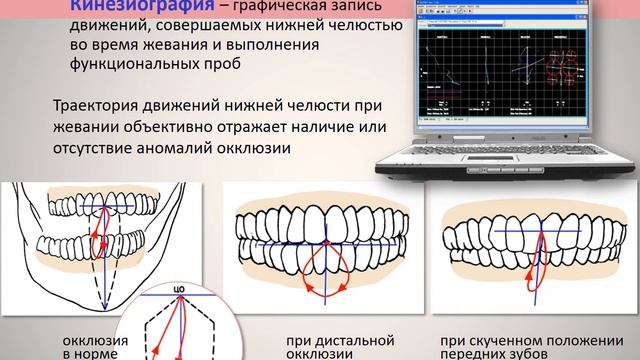 5.6д Функциональные методы диагностики смотреть онлайн