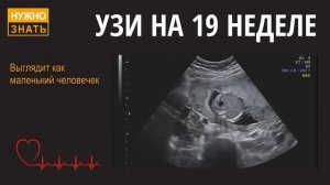 19 неделя беременности. Развитие плода. УЗИ в 3D. Как себя чувствует беременная. Как плод?