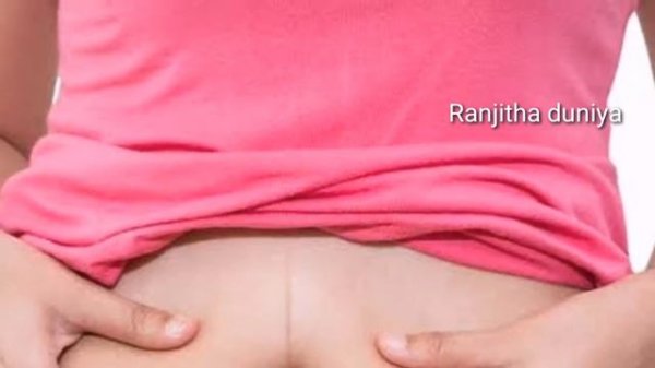 Dark line on stomach during pregnancy in kannada | ಪ್ರೆಗ್ನೆನ್ಸಿಯಲ್ಲಿ dark line ಯಾಕೆ ಕಾಣಿಸಿಕೊಳ್ಳುತ್ತ
