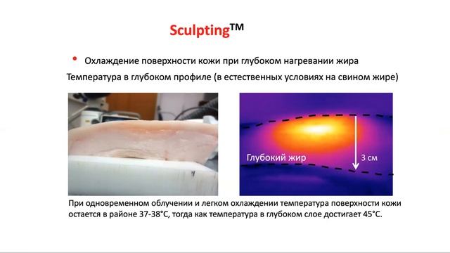 Выбор технологий с учетом принципа работы физического фактора на уровне ткани мишени смотреть онлайн