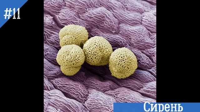 20 Фантастических фотографий предметов и существ под микроскопом смотреть онлайн