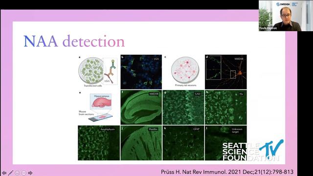 Neurology Grand Rounds- Brain on Fire & Other Lessons of Autoimmune Encephalitis- Pavel Repovic, M смотреть онлайн