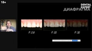 Основы дентальной фотографии Как стоматологу настроить камеру  под портретную и внутриротовую съемк