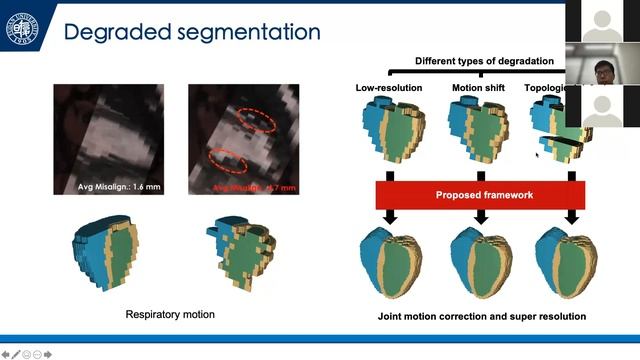 Data Learning - Generative model-based super-resolution and quality control for cardiac segmentatio смотреть онлайн