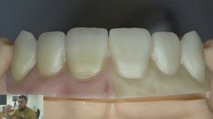 схема нанесение жидкой керамики miyo. Циркониевые коронки.