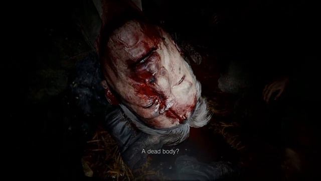 Ethan Winters Fingers Bitten by Werewolf | Resident Evil 8 Village смотреть онлайн