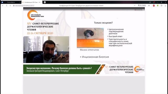 Эксцизия при меланоме. Почему биопсия должна быть «умной»? смотреть онлайн