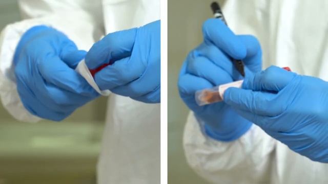 Методика забора клинического материала для диагностики коронавирусной инфекции COVID-19 смотреть онлайн