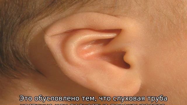 Почему у новорожденного разные уши — возможные причины смотреть онлайн