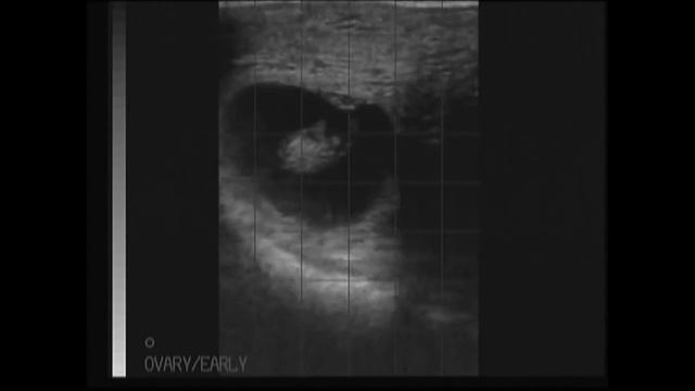 "Ложная беременность" у коров или что такое ПЖТ смотреть онлайн