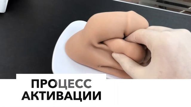 Фаллопротезирование. Принцип работы трёхкомпонентного имплантата. Titan touch (Coloplast) смотреть онлайн
