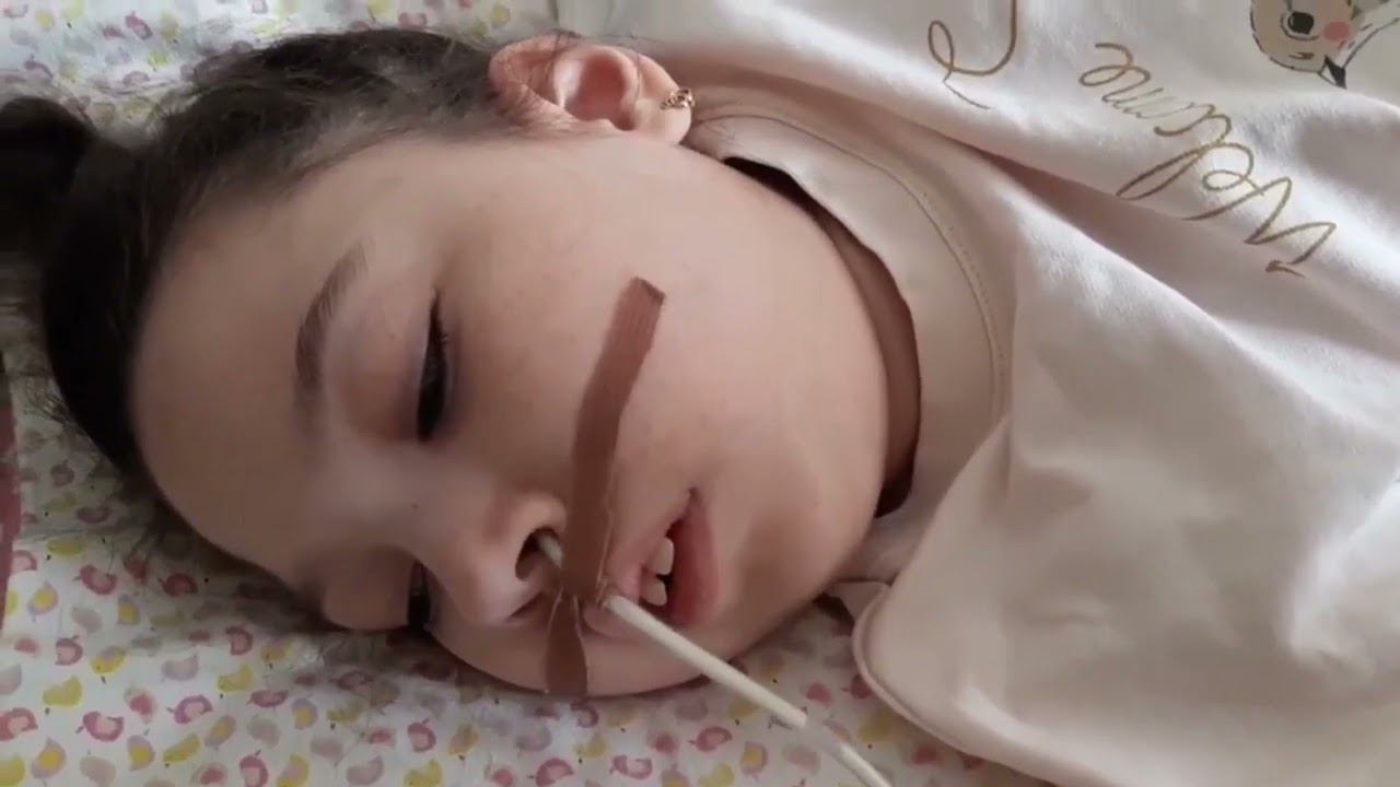 Алена ДЦП, восстановление после комы   клеточные концентраты растений   Эволюция Природы