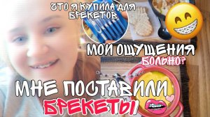 МНЕ ПОСТАВИЛИ БРЕКЕТЫ/БОЛЬНО?/МОИ ЭМОЦИИ ПОСЛЕ УСТАНОВКИ БРЕКЕТОВ/ПОКУПКИ ДЛЯ БРЕКЕТОВ?