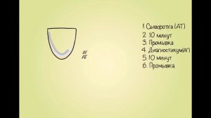 Иммуноферментный анализ (ИФА)