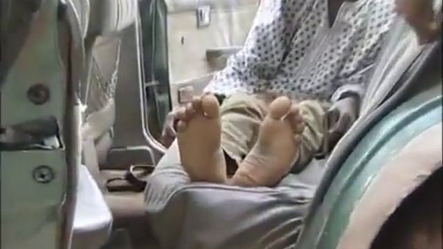 Бог исцеляет переломы ног, God heals Broken bones! смотреть онлайн