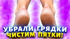 У меня пятки всегда как у «младенца». Дешёвый способ, который  поможет убрать грубую кожу на ногах.