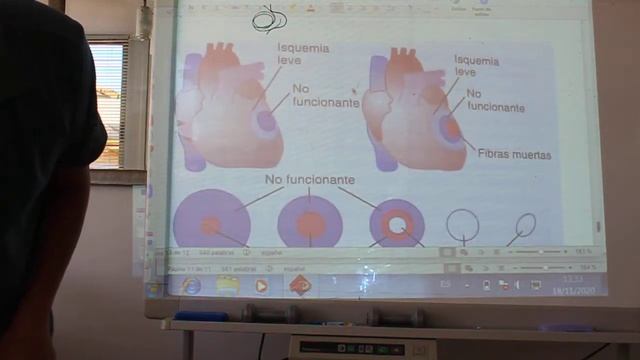 FISIO 22 CORONARIA 3 смотреть онлайн