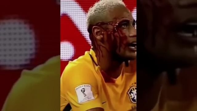 Неймару разбили лицо смотреть онлайн