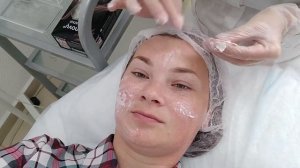 Как проводится пилинг кожи лица