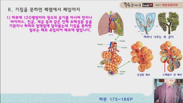 기침 63강. 기침과 폐암 이야기. 기침은 기관과 폐포의 염증이나 노폐물을 빼내는 것. Coughing and Lung Cancer Stories. смотреть онлайн