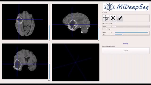 Demo of MIDeepSeg for Interactive Medical Image Segmentation/Annotation смотреть онлайн