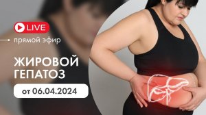 Жировой гепатоз