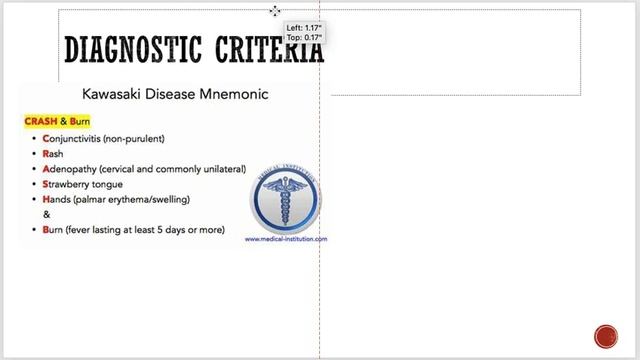 Henoch schonlein purpura and kawasaki disease смотреть онлайн