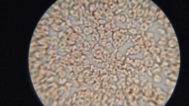 Влияние ОЛИВКОВОГО масла на кровь. ОБЪЯВЛЕНИЕ смотреть онлайн