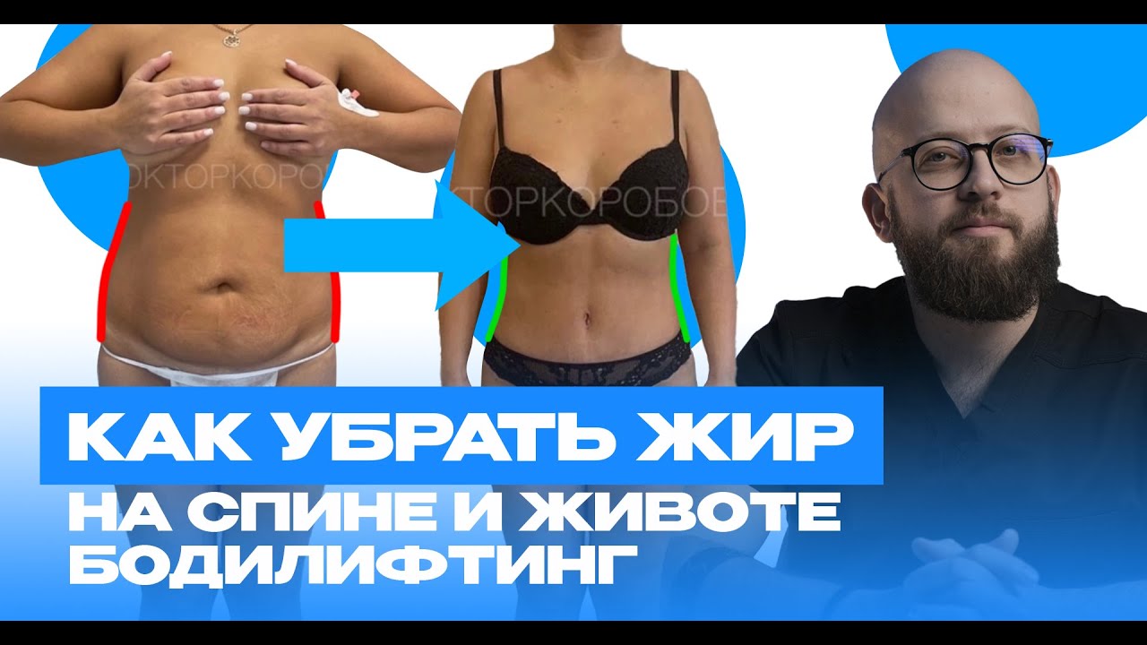 Как убрать жир на животе и спине. Бодилифтинг смотреть онлайн