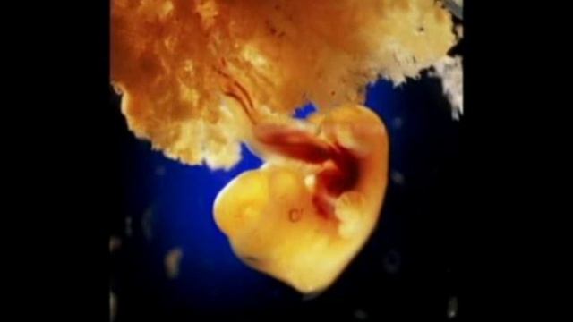 Жизнь до рождения. Развитие эмбриона человека.