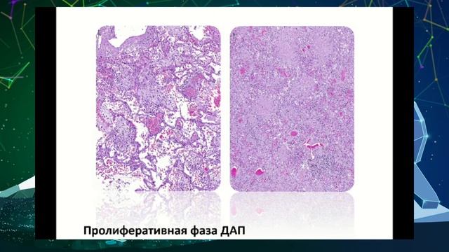 Мультидисциплинарная пульмонологическая школа - Самсонова Мария Викторовна смотреть онлайн