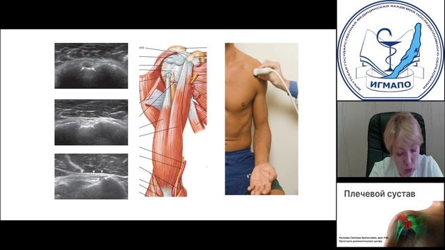 Плечевой сустав смотреть онлайн