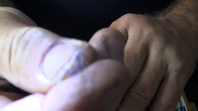 Шуйская гармонь, "лечение больного" голоса -2 ролик смотреть онлайн